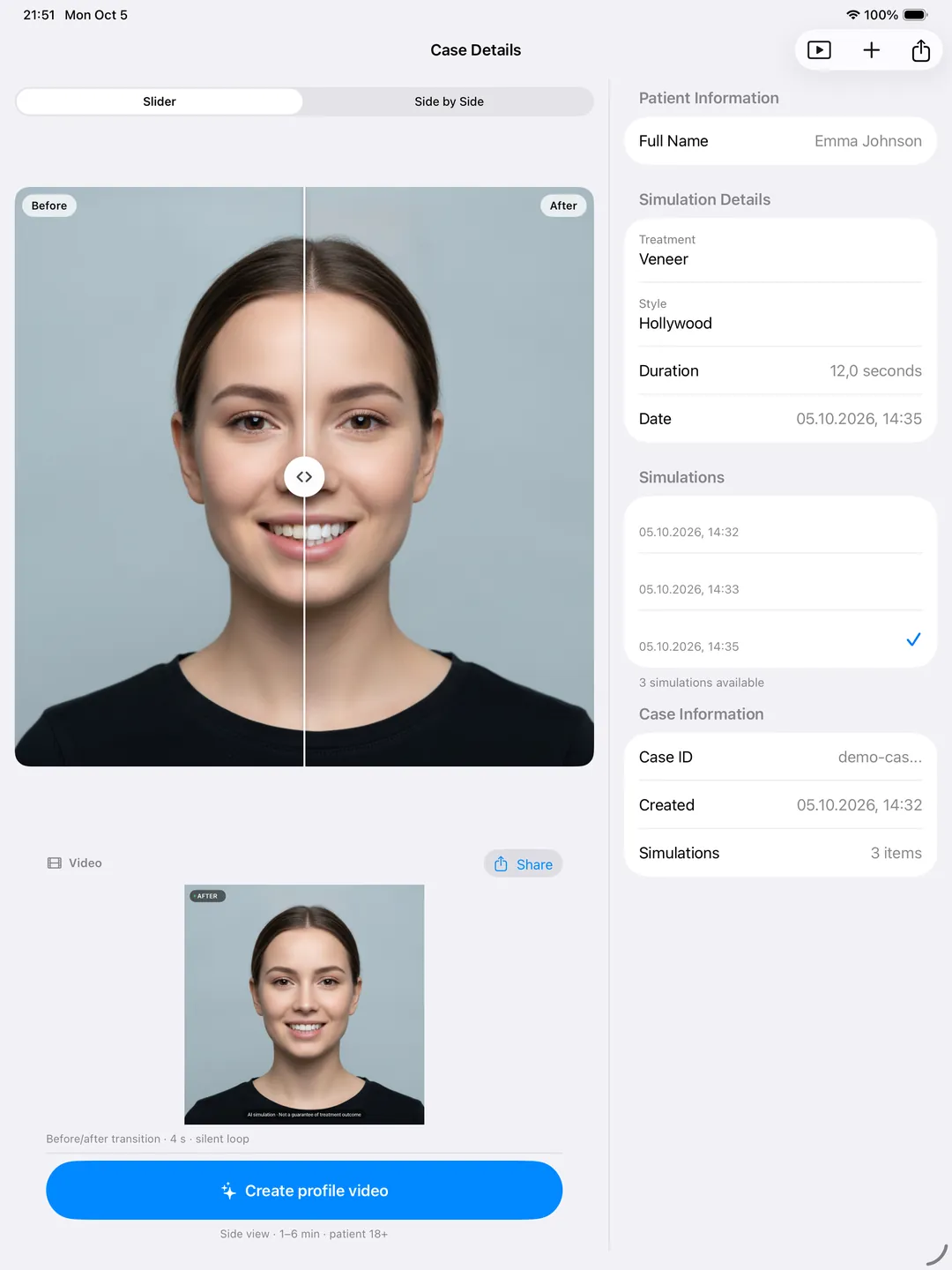 DentAI on iPad: case details with a before and after smile simulation slider