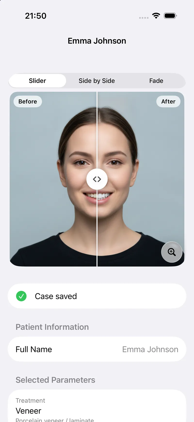 DentAI on iPhone: a smile simulation with the before and after slider